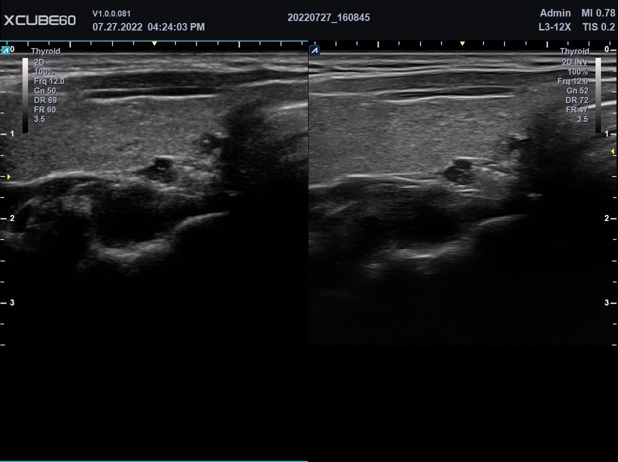 HARMONIC IMAGING On Off