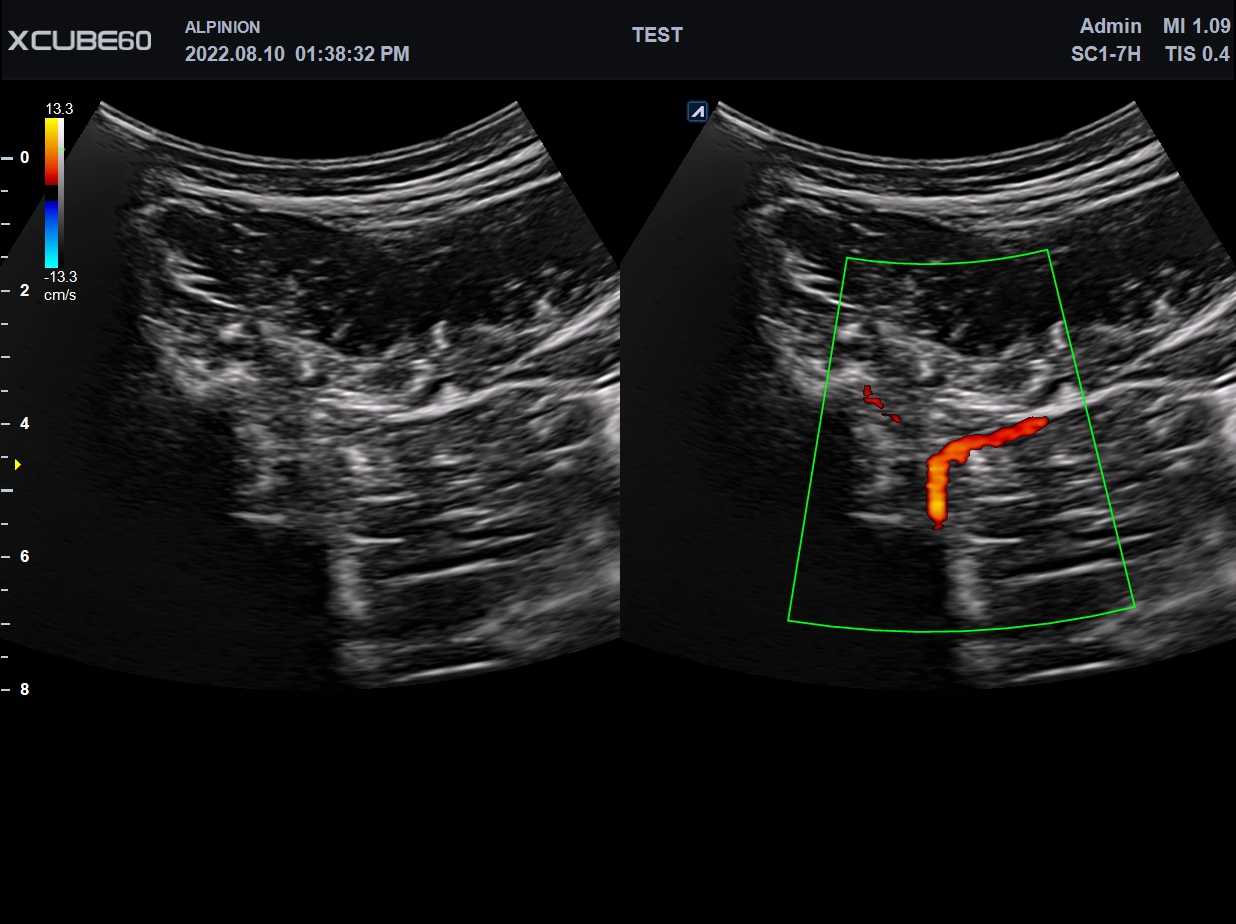 MSK_spine
